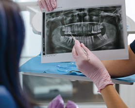 two people inspecting an x-ray