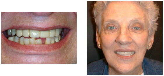 Patient's before and after photos - 5