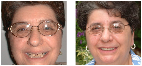 Patient's before and after photos - 8