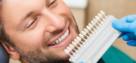 man smiling while a dentist holds up a tooth color comparison chart