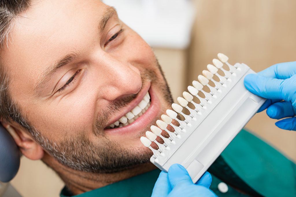 Smiling man with a tooth color comparison chart