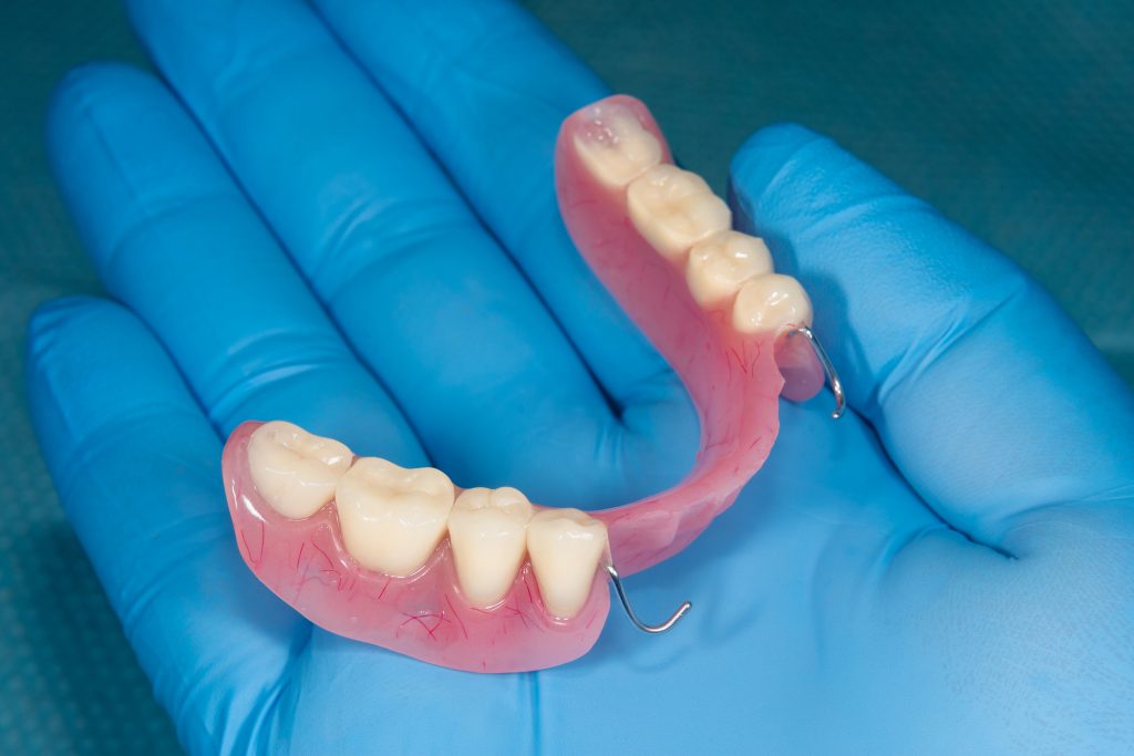 partial dentures in a hand